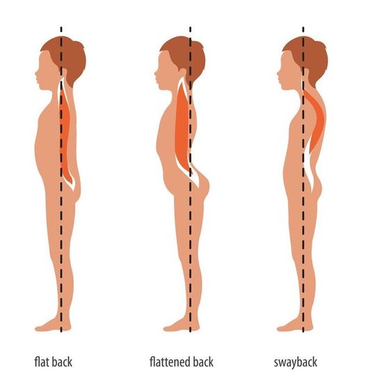 脊椎排列